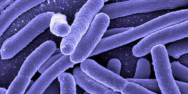 Jedan od gadnijih ortaka sa planete Zemlje: escherichia coli.